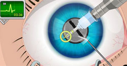 eye-surgery