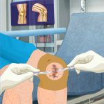 Knee Surgery Simulator 2016 ist da … äh, was?